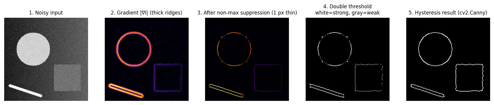 Canny stages: gradient, NMS, double threshold, hysteresis