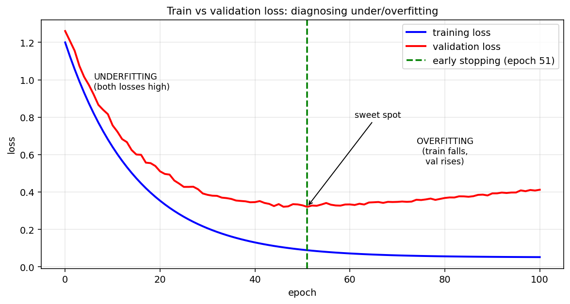 Figure 4: Training loss (blue) keeps falling, validation loss (red) bottoms out and rises again — the rise marks the start of overfitting; the green dashed line is where early stopping would halt training. | বাংলা: train loss (নীল) নামতেই থাকে, কিন্তু validation loss (লাল) নেমে গিয়ে আবার উঠে যায় — ওঠা শুরুর বিন্দুটাই overfitting-এর সূচনা, সবুজ দাগে early stopping থামিয়ে দেয়।